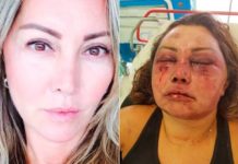 Justiça do RJ determina prisão preventiva de acusado de espancar paisagista