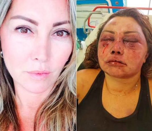 Justiça do RJ determina prisão preventiva de acusado de espancar paisagista