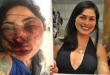 Mulher fica desfigurada após ser agredida por namorado