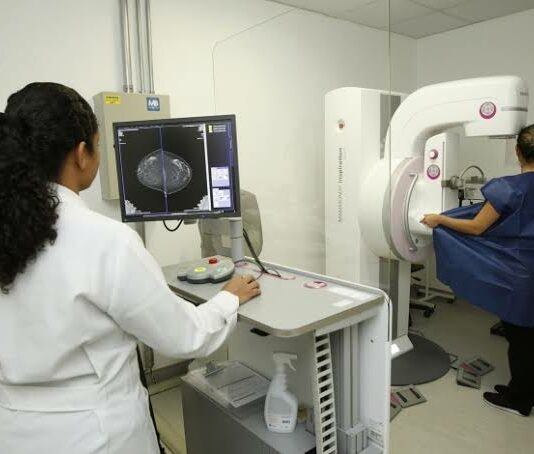 MPF garante ampliação de acesso à mamografia em municípios do Noroeste Fluminense