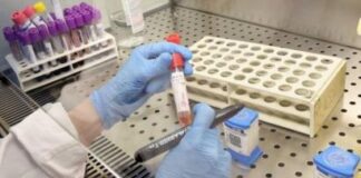 Sobe para 8 o número de pacientes confirmados com COVID-19 em Itaperuna