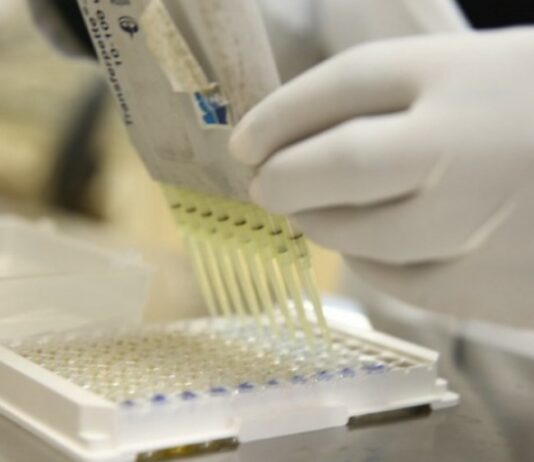 Bom Jesus do Itabapoana tem caso de COVID-19 confirmado e uma morte está sendo investigada