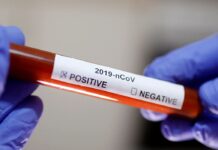 SES confirma o primeiro caso de COVID-19 em Itaperuna