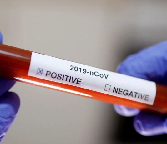 SES confirma o primeiro caso de COVID-19 em Itaperuna