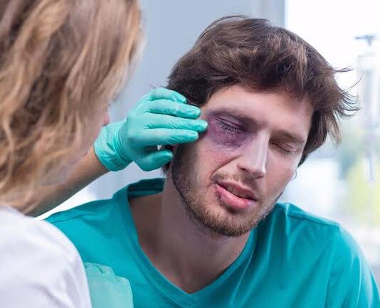 Ano Novo: oftalmologista alerta para acidentes oculares com fogos de artifício