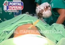 Idoso de Varre-Sai dá entrada no HSJA em Itaperuna com faca fincada no abdômen